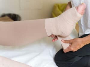 Cura piaghe da decubito sul piede Fasciatura e cura piaghe da decubito