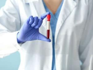 provetta di sangue utilizzata per servizio prelievi a domicilio servizio prelievi a domicilio